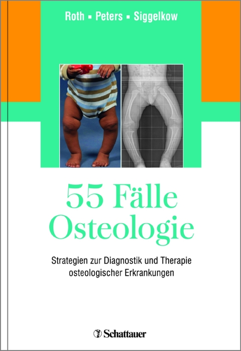 55 F&auml;lle Osteologie - 
