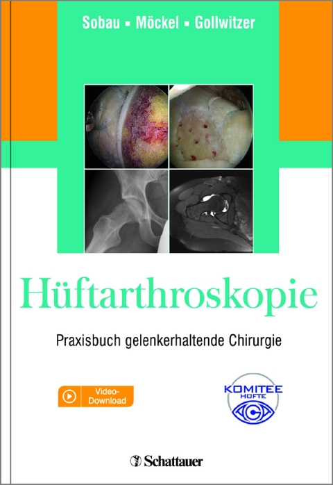 H&uuml;ftarthroskopie - 