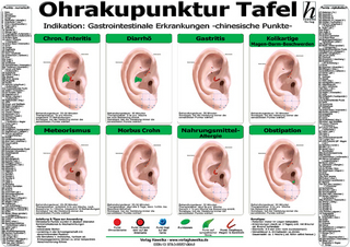 Ohrakupunktur Tafel - Indikation: Gastrointestinale Erkrangungen