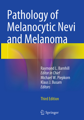 Pathology of Melanocytic Nevi and Melanoma