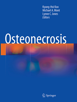 Osteonecrosis