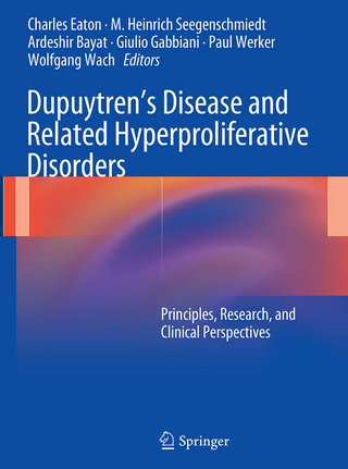 Dupuytren’s Disease and Related Hyperproliferative Disorders