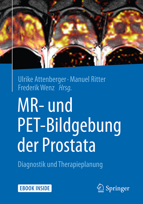 MR- und PET-Bildgebung der Prostata - 