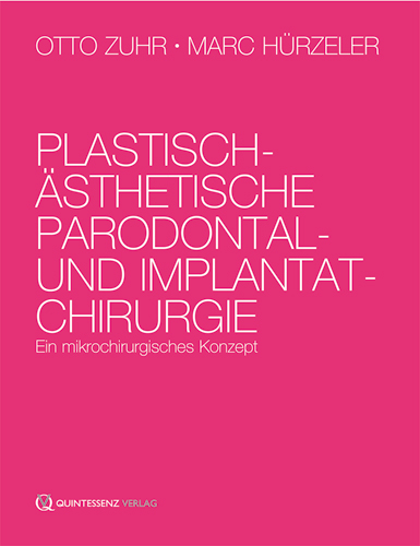 Plastisch-ästhetische Parodontal- und Implantatchirurgie - Otto Zuhr, Marc Hürzeler