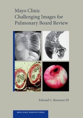 Mayo Clinic Challenging Images for Pulmonary Board Review - III Rosenow  Edward C.