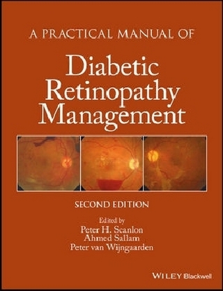 A Practical Manual of Diabetic Retinopathy Management