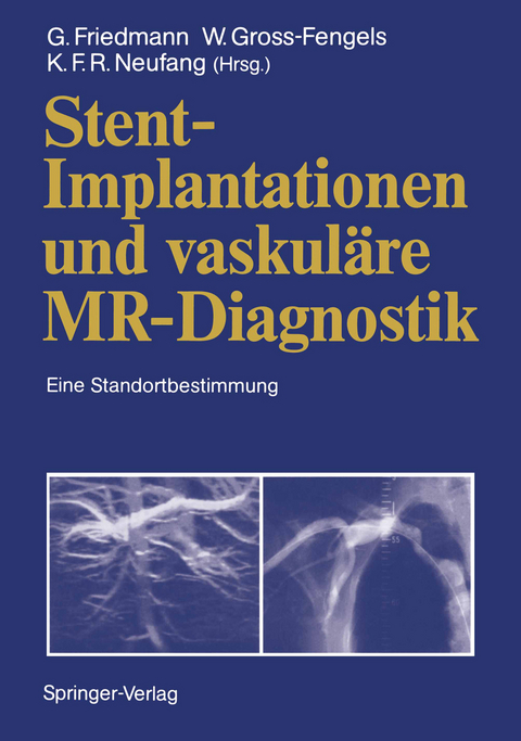 Stent-Implantationen und vaskul&auml;re MR-Diagnostik - 