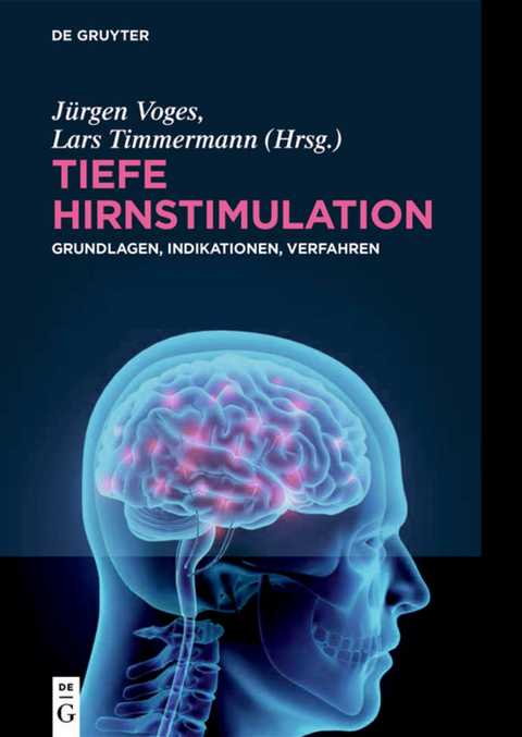 Tiefe Hirnstimulation - 