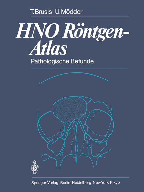 HNO R&ouml;ntgen-Atlas - Tilman Brusis, Ulrich M&ouml;dder
