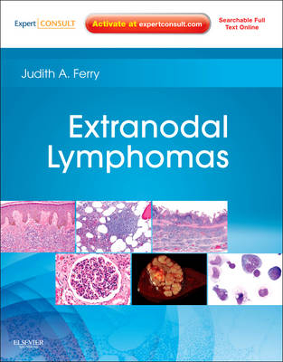 Extranodal Lymphomas - Judith A. Ferry