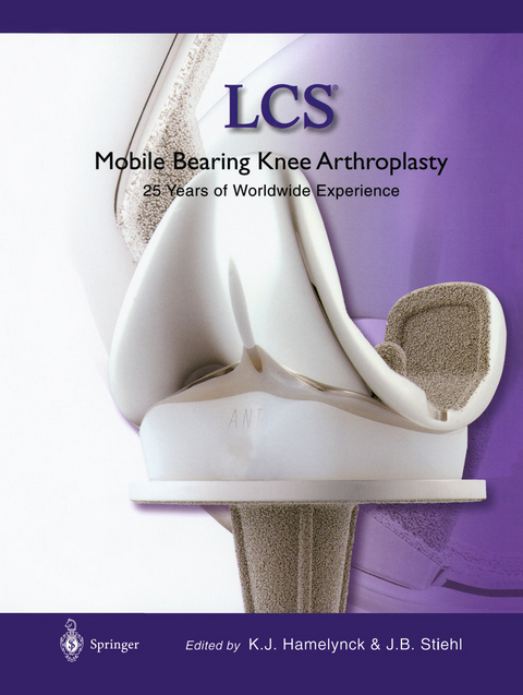 LCS&reg; Mobile Bearing Knee Arthroplasty - 