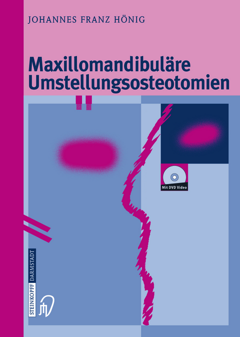 Maxillomandibul&auml;re Umstellungsosteotomien - Johannes-Franz H&ouml;nig