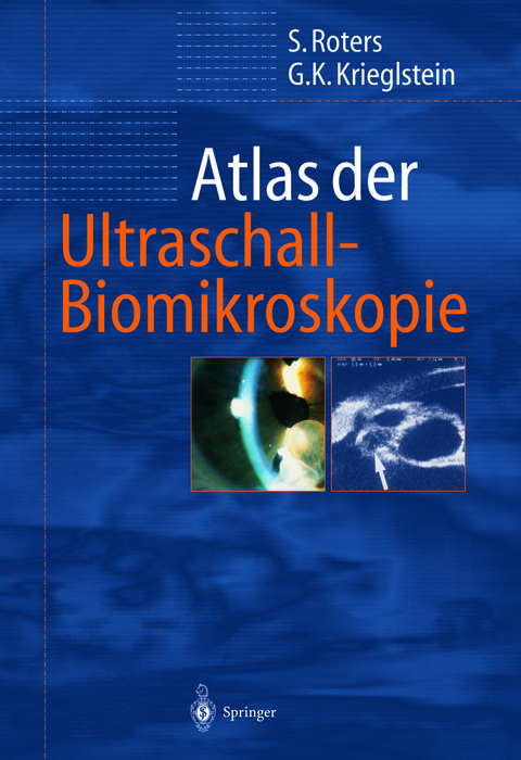 Atlas der Ultraschall-Biomikroskopie - Sigrid Roters, G&uuml;nter K. Krieglstein