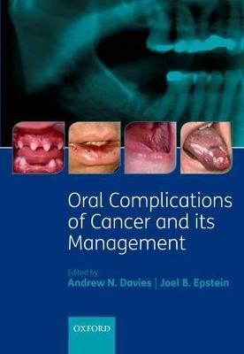 Oral Complications of Cancer and its Management