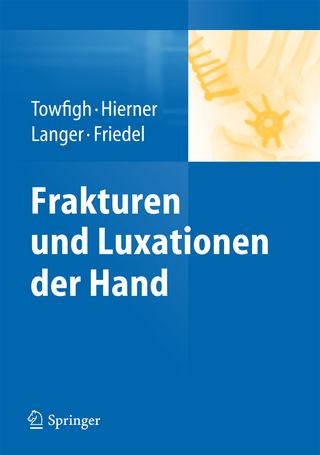 Frakturen und Luxationen der Hand