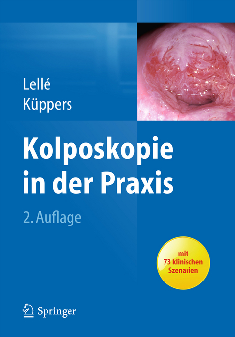 Kolposkopie in der Praxis - Ralph J. Lell&eacute;, Volkmar K&uuml;ppers