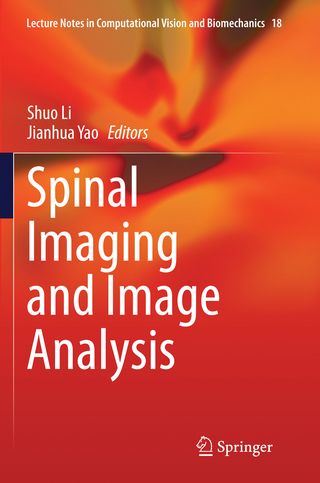 Spinal Imaging and Image Analysis