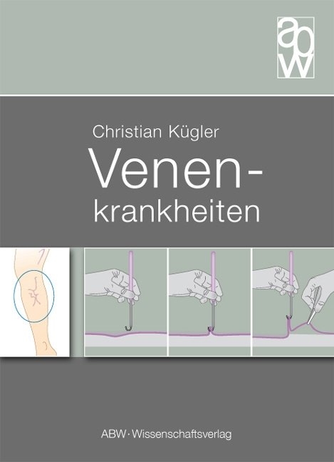 Venenkrankheiten - Christian Kügler