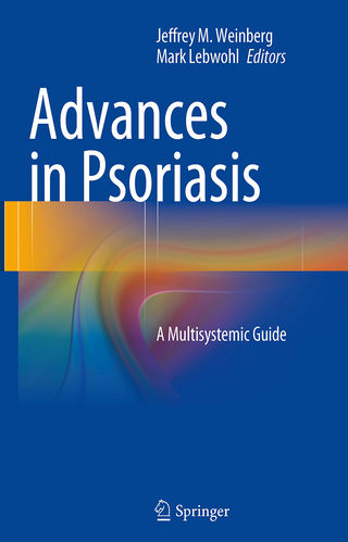 Advances in Psoriasis