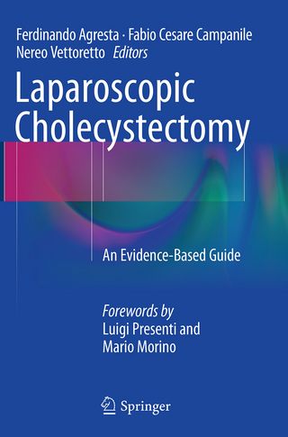 Laparoscopic Cholecystectomy