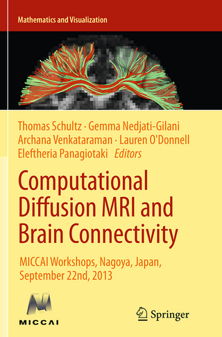 Computational Diffusion MRI and Brain Connectivity