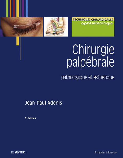 Chirurgie palpebrale -  Jean-Paul Adenis