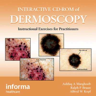 Interactive CD-ROM of Dermoscopy - Ashfaq A. Marghoob, MD Braun  Ralph, Alfred W. Kopf