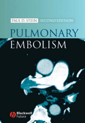Pulmonary Embolism - Paul D. Stein