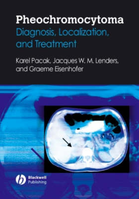 Pheochromocytoma - Karel Pacak, Graeme Eisenhofer, Jacques Lenders