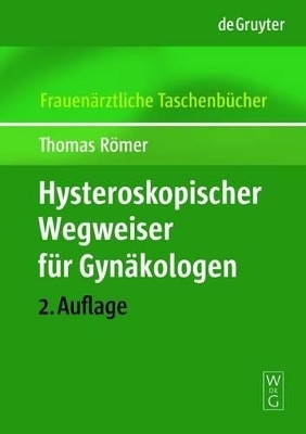 Hysteroskopischer Wegweiser f&uuml;r Gyn&auml;kologen - Thomas R&ouml;mer
