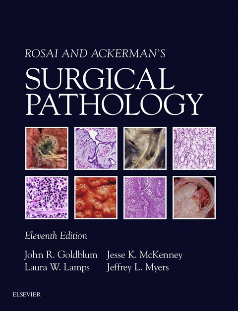 Rosai and Ackerman's Surgical Pathology E-Book -  John R. Goldblum,  Laura W. Lamps,  Jesse K. McKenney