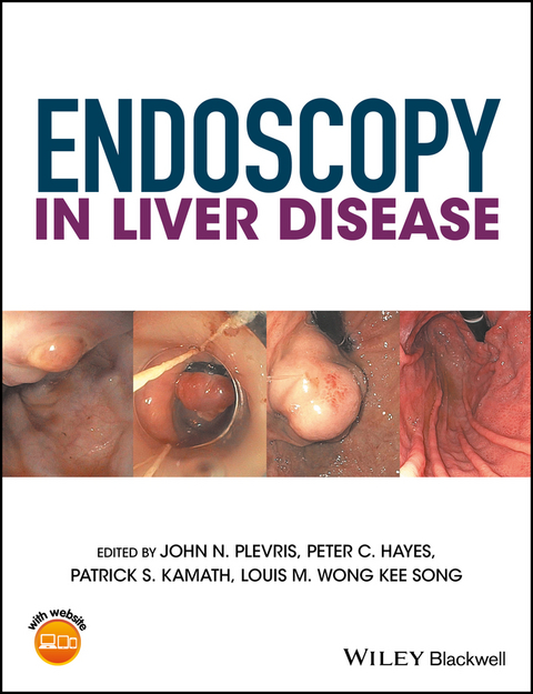Endoscopy in Liver Disease - 