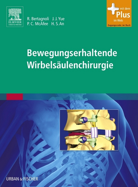Bewegungserhaltende Wirbels&auml;ulenchirurgie - 
