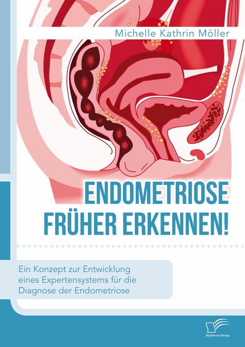 Endometriose fr&uuml;her erkennen! Ein Konzept zur Entwicklung eines Expertensystems f&uuml;r die Diagnose der Endometriose -  Michelle Kathrin M&ouml;ller
