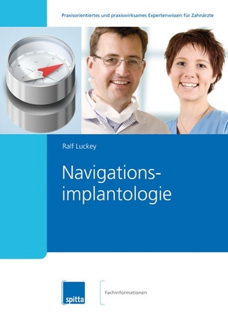 Navigationsimplantologie