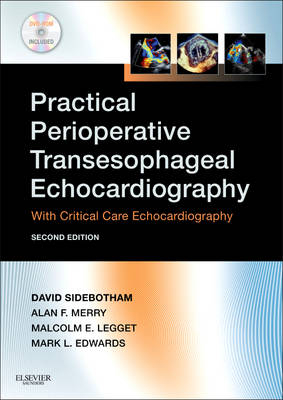 Practical Perioperative Transesophageal Echocardiography - David Sidebotham, Alan Merry, Malcolm Legget