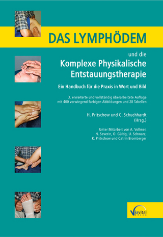 Das Lymphödem und die Komplexe Physikalische Entstauungstherapie