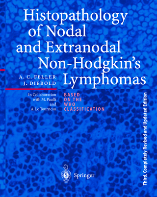 Histopathology of Nodal and Extranodal Non-Hodgkin’s Lymphomas