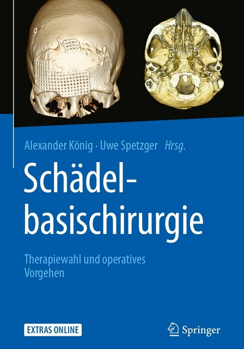 Sch&auml;delbasischirurgie - 