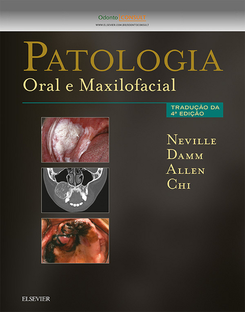 Patologia Oral e Maxilofacial -  Brad Neville