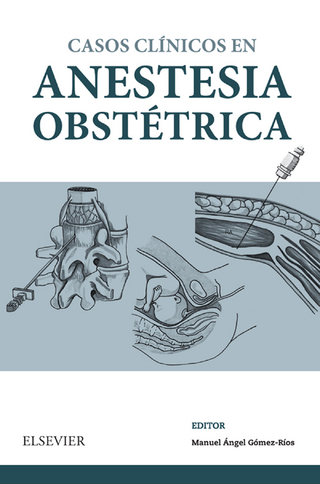 Casos Clínicos en anestesia obstétrica