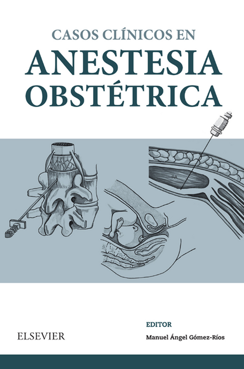 Casos Cl&iacute;nicos en anestesia obst&eacute;trica - 