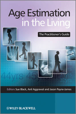 Age Estimation in the Living - 