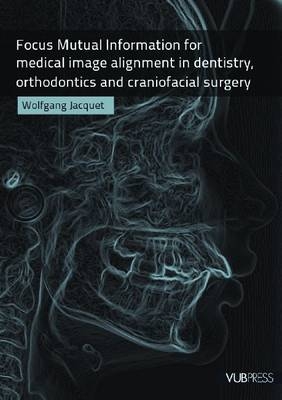 Focus Mutual Information for Medical Image Alignment in Dentistry, Orthodontics and Craniofacial Surgery