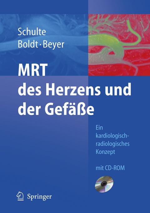 MRT des Herzens und der Gef&auml;&szlig;e - B. Schulte, A. Boldt, D. Beyer