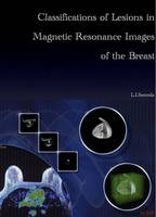 Classifications of Lesions in Magnetic Resonance Images of the Breast