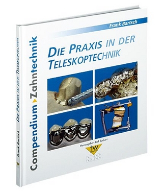 Die Praxis in der Teleskoptechnik
