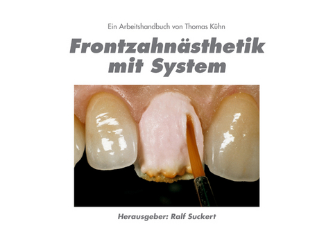 Frontzahnästhetik mit System - Thomas Kühn