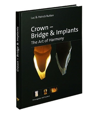 Crown - Bridge & Implants