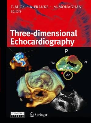 3D-echocardiography
